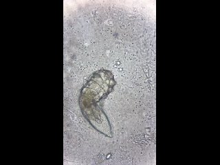 this happens on your face